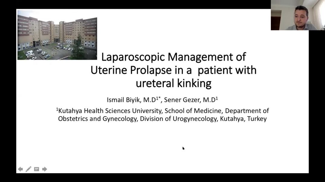 ⁣Laparoscopic management of uterine prolapsus | Ismail Biyik