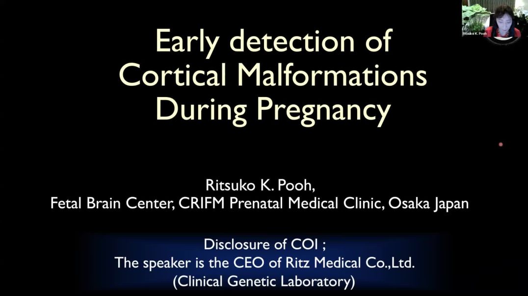 ⁣Early Detection of Cortical Malformations During Pregnancy | Ritsuko Pooh